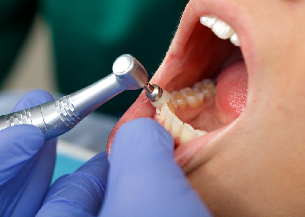 Higiene dental en servicos odontologos
